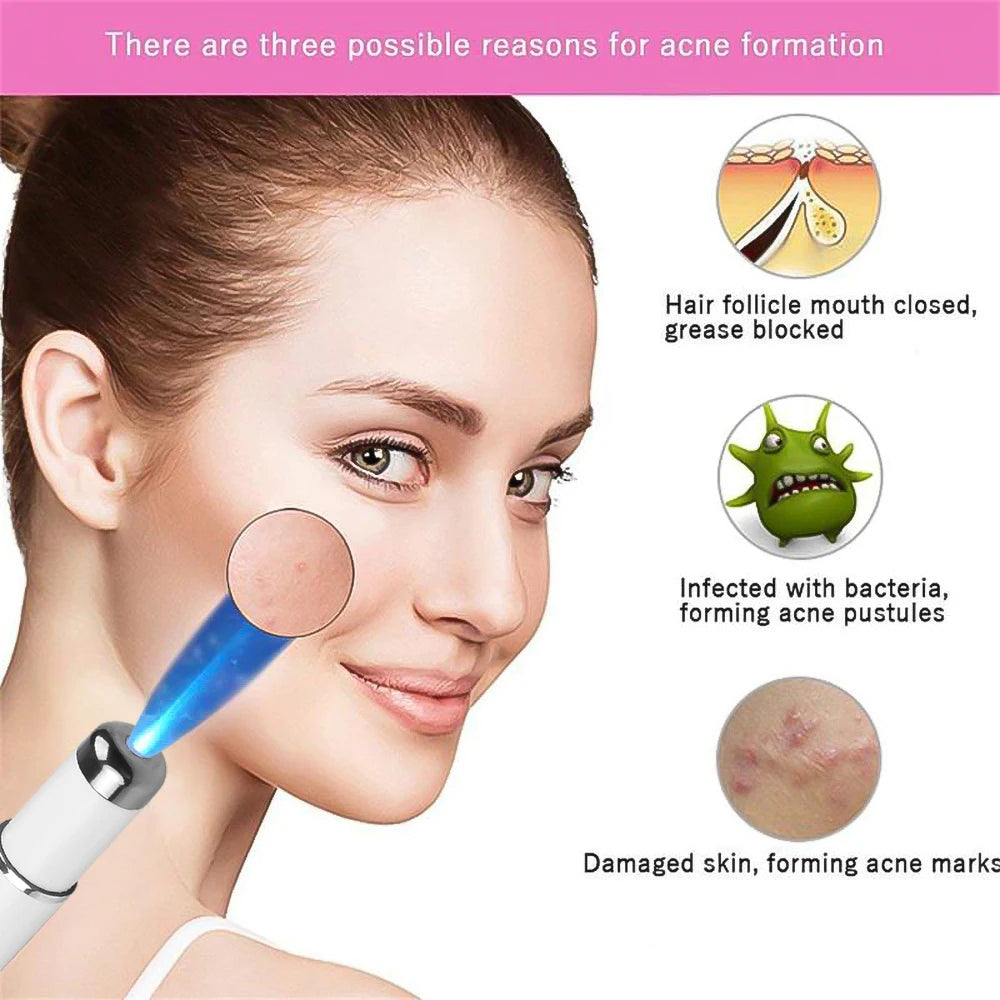 Blue Light Acne Remover Pen