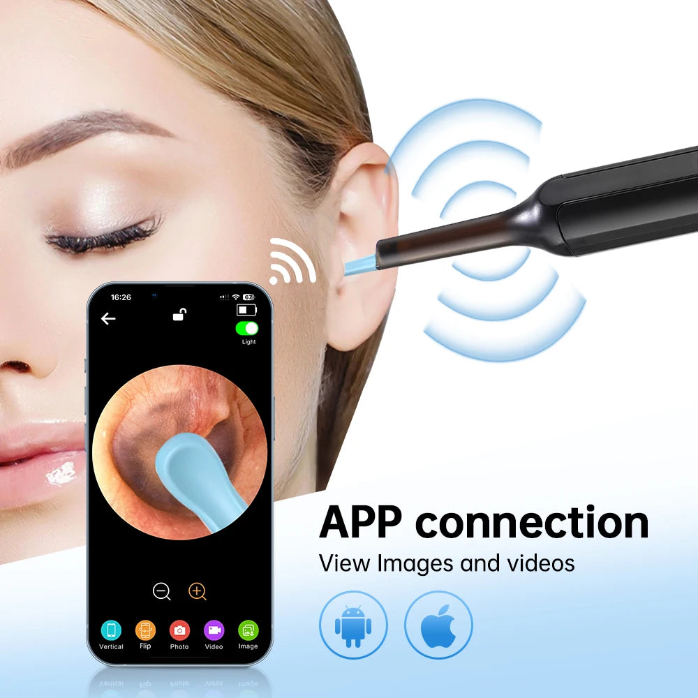 Smart Visual LED Ear Cleaner