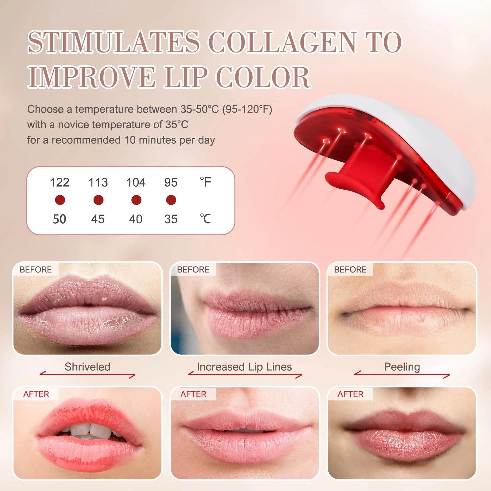 Lip Plumper Red Light Device