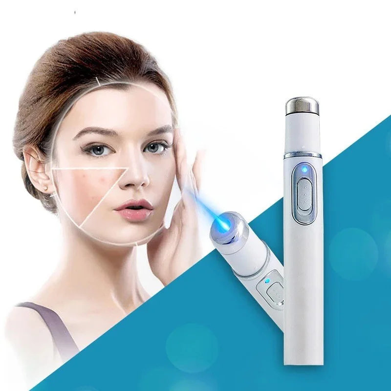 Blue Light Acne Remover Pen