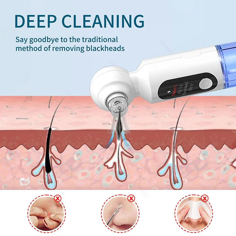 Blackhead Remover Vacuum