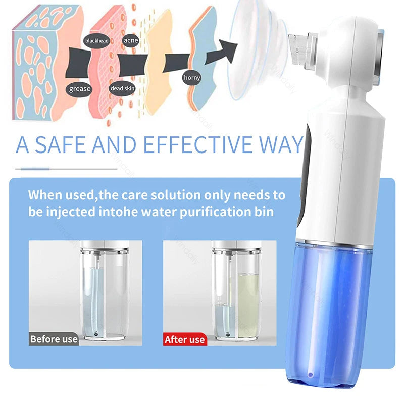 Blackhead Remover Vacuum