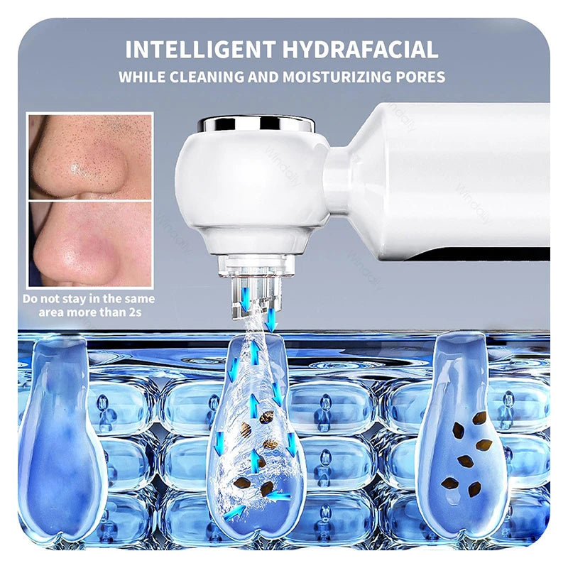 Blackhead Remover Vacuum